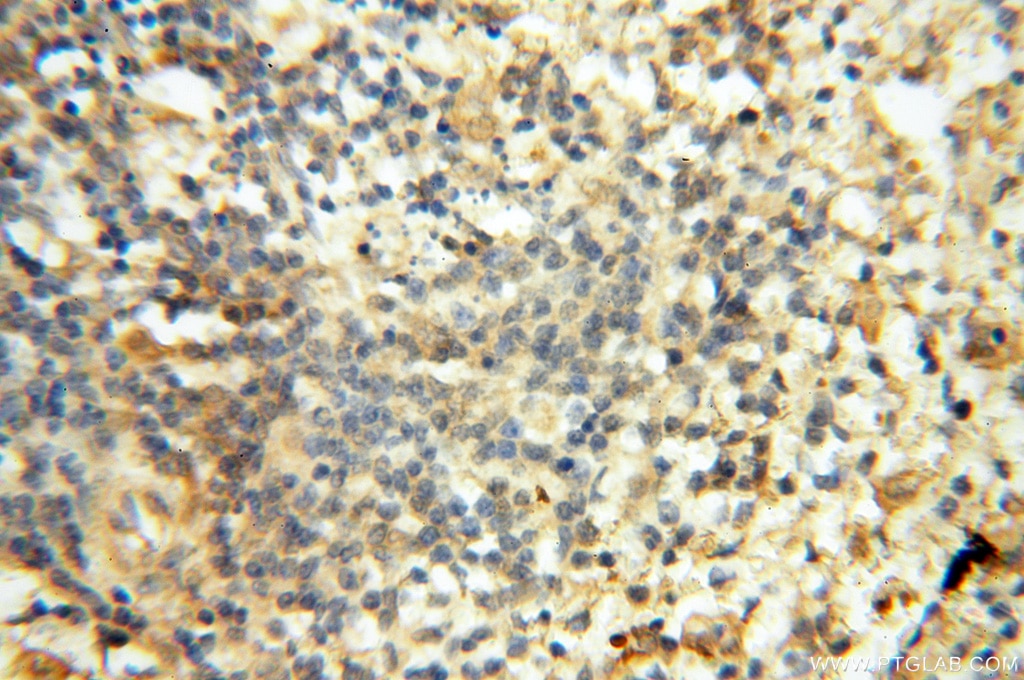 IHC staining of human spleen using 18029-1-AP