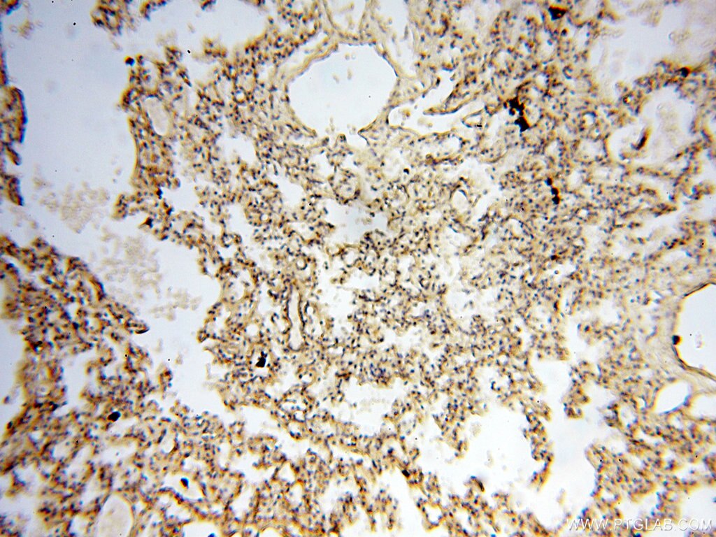 Immunohistochemistry (IHC) staining of human lung tissue using CARD6 Polyclonal antibody (18029-1-AP)