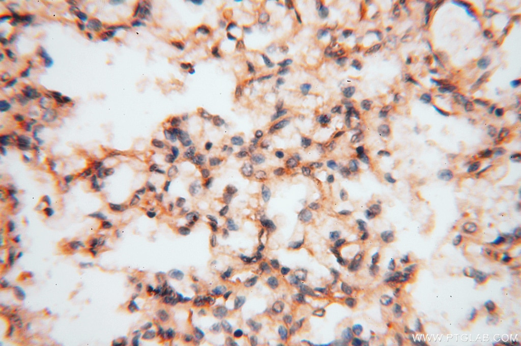 Immunohistochemistry (IHC) staining of human lung tissue using CARD6 Polyclonal antibody (18029-1-AP)