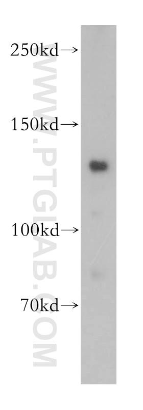 Western Blot (WB) analysis of HepG2 cells using CARD6 Polyclonal antibody (18029-1-AP)