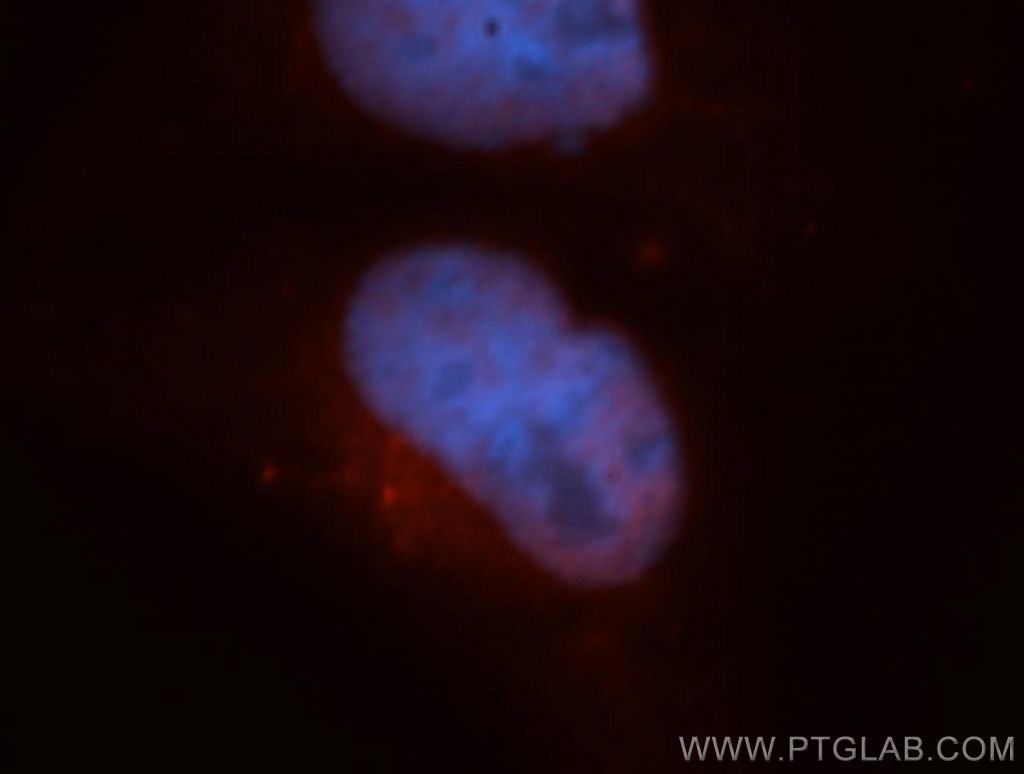 Immunofluorescence (IF) / fluorescent staining of HepG2 cells using CARD8 Polyclonal antibody (14516-1-AP)
