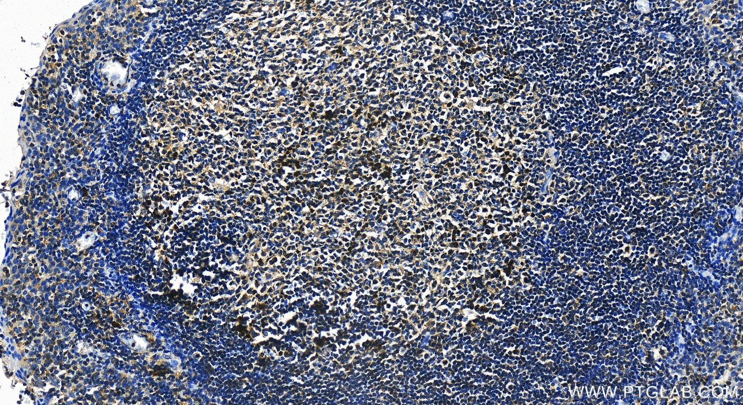 Immunohistochemistry (IHC) staining of human tonsillitis tissue using CARD8 Polyclonal antibody (14516-1-AP)