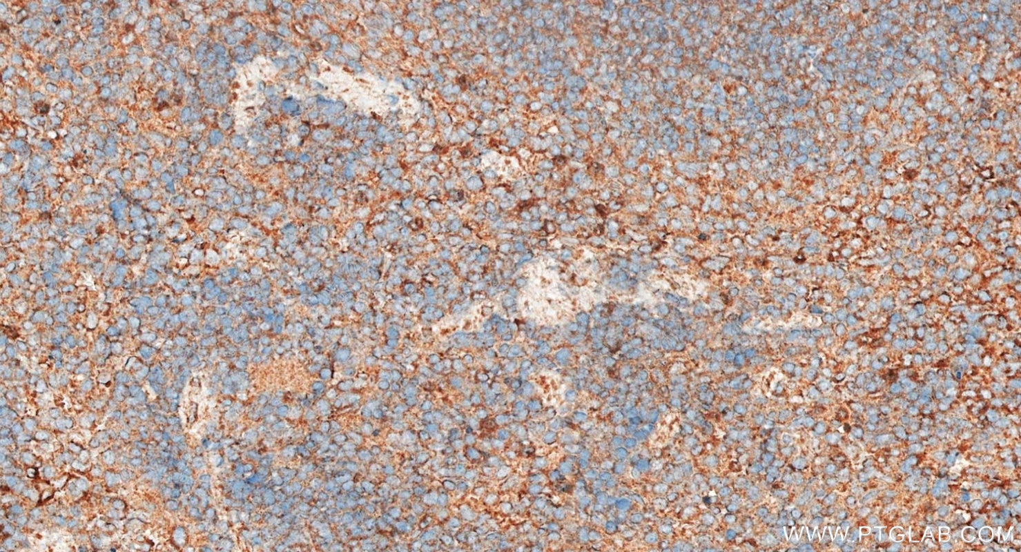 Immunohistochemistry (IHC) staining of mouse spleen tissue using CARD9 Polyclonal antibody (10669-1-AP)
