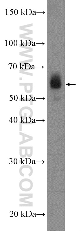 Western Blot (WB) analysis of HL-60 cells using CARD9 Polyclonal antibody (10669-1-AP)