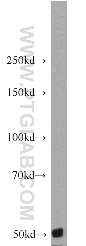 Western Blot (WB) analysis of PC-3 cells using CARD9 Polyclonal antibody (10669-1-AP)