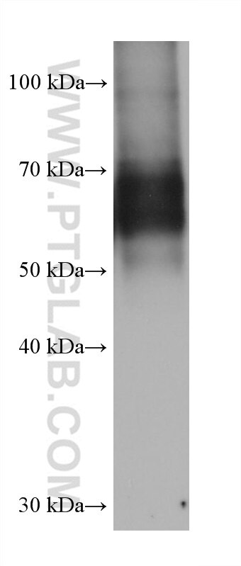 Western Blot (WB) analysis of U-937 cells using CARD9 Monoclonal antibody (68657-1-Ig)