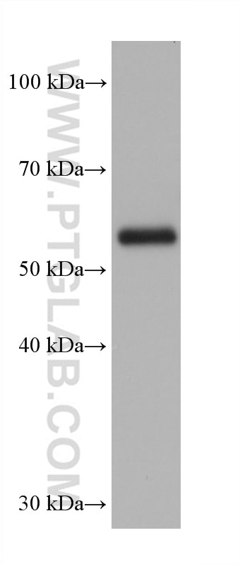 Western Blot (WB) analysis of TF-1 cells using CARD9 Monoclonal antibody (68657-1-Ig)