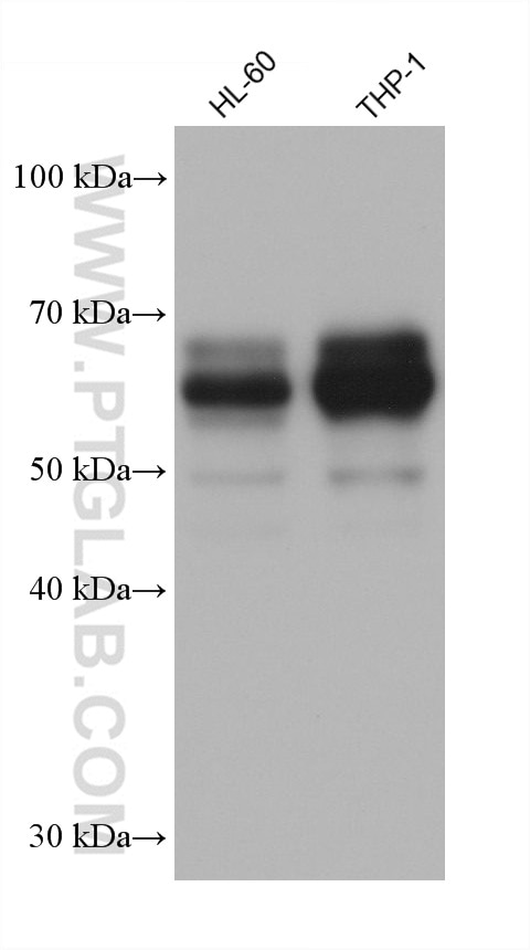 Western Blot (WB) analysis of various lysates using CARD9 Monoclonal antibody (68657-1-Ig)