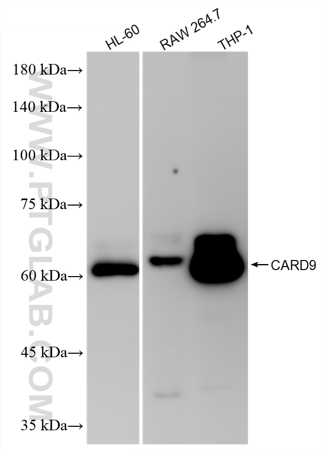 WB analysis using 85749-1-RR Western Blot (WB) analysis of various lysates using CARD9 Recombinant monoclonal antibody (85749-1-RR)