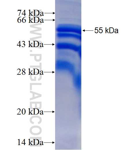 CARD9 fusion protein Ag1057 SDS-PAGE