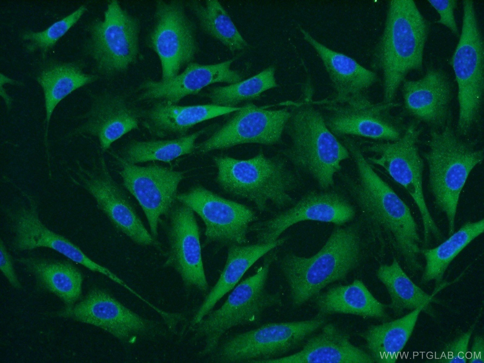 Immunofluorescence (IF) / fluorescent staining of NIH/3T3 cells using CARM1 Polyclonal antibody (55246-1-AP)