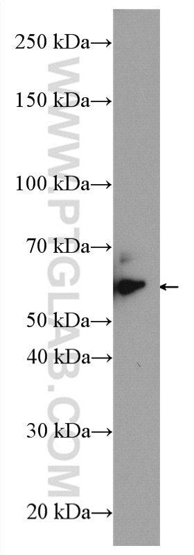 Western Blot (WB) analysis of HEK-293 cells using CARM1 Polyclonal antibody (55246-1-AP)