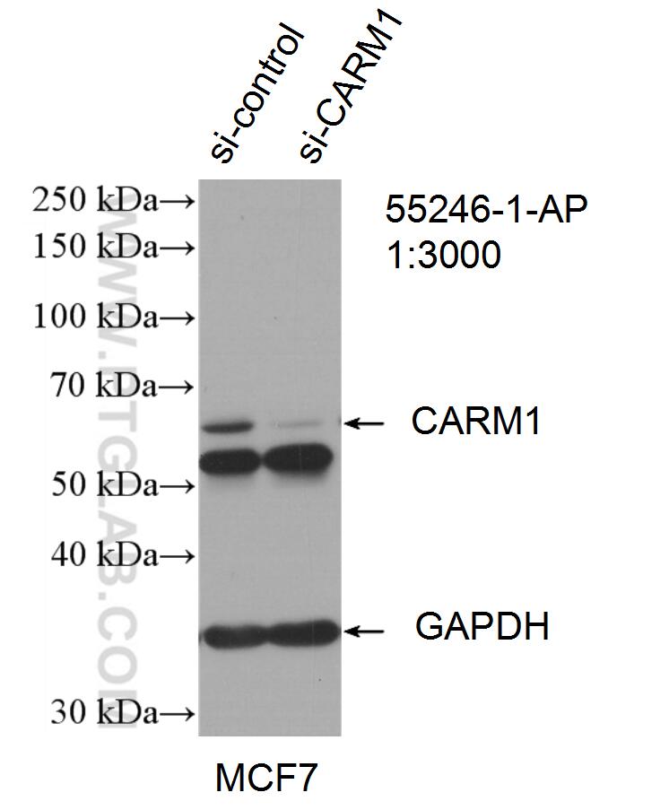 Western Blot (WB) analysis of MCF-7 cells using CARM1 Polyclonal antibody (55246-1-AP)