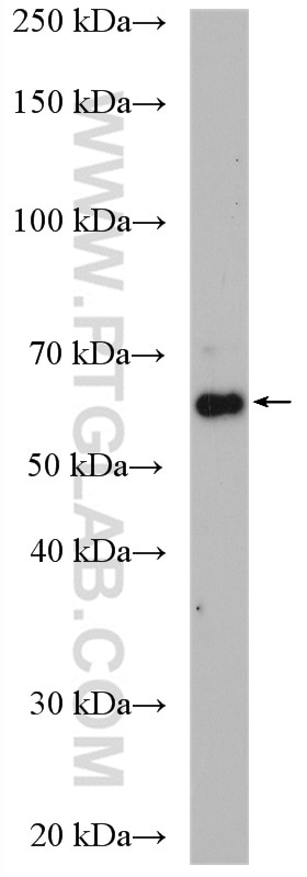 Western Blot (WB) analysis of NIH/3T3 cells using CARM1 Polyclonal antibody (55246-1-AP)