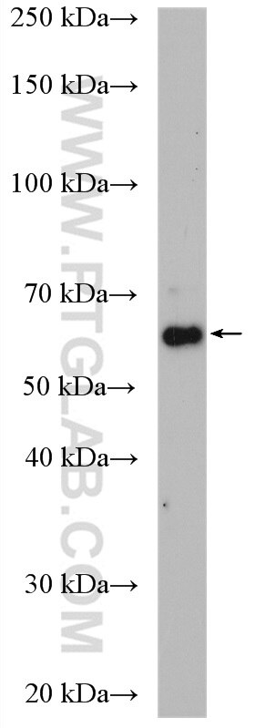 Western Blot (WB) analysis of NIH/3T3 cells using CARM1 Polyclonal antibody (55246-1-AP)