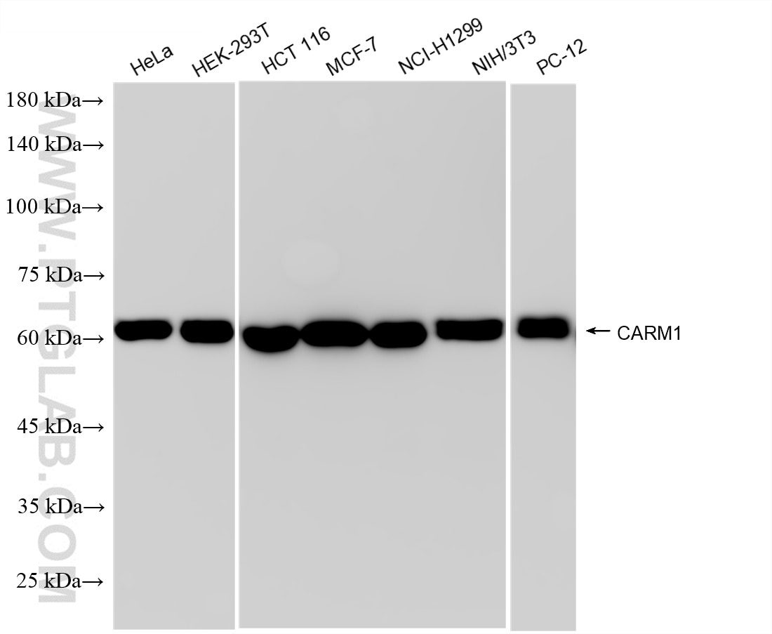 Western Blot (WB) analysis of various lysates using CARM1 Recombinant antibody (85146-3-RR)