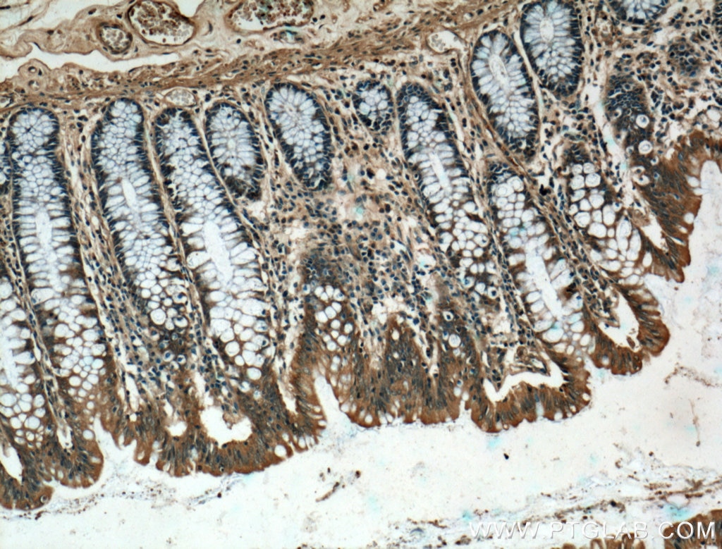 Immunohistochemistry (IHC) staining of human colon tissue using CARMIL Polyclonal antibody (27133-1-AP)