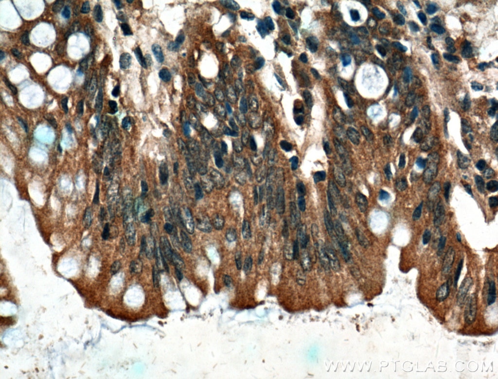 Immunohistochemistry (IHC) staining of human colon tissue using CARMIL Polyclonal antibody (27133-1-AP)