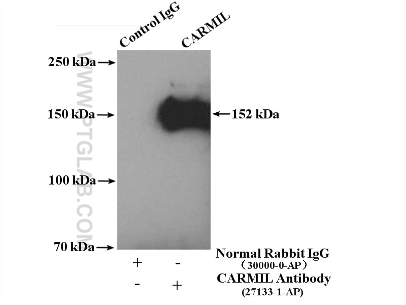 Immunoprecipitation (IP) experiment of MCF-7 cells using CARMIL Polyclonal antibody (27133-1-AP)