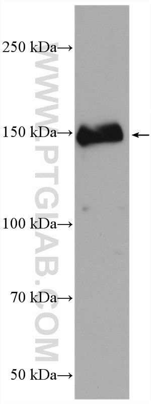 Western Blot (WB) analysis of MCF-7 cells using CARMIL Polyclonal antibody (27133-1-AP)