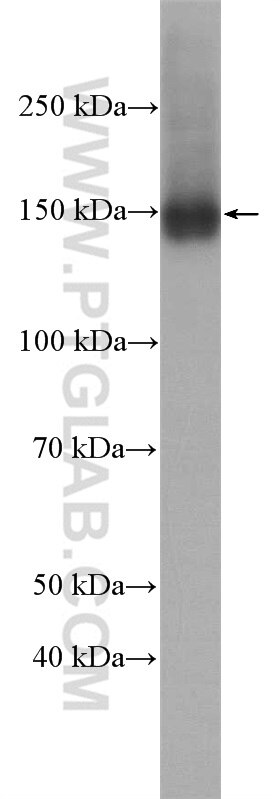 Western Blot (WB) analysis of HeLa cells using CARMIL Polyclonal antibody (27133-1-AP)