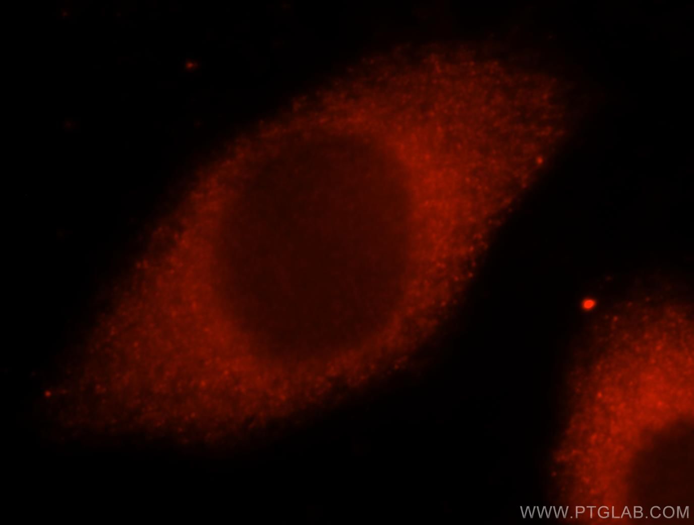 Immunofluorescence (IF) / fluorescent staining of MCF-7 cells using CARS Polyclonal antibody (15296-1-AP)