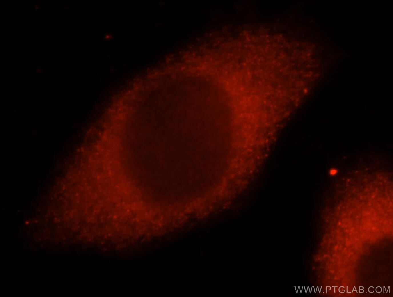 Immunofluorescence (IF) / fluorescent staining of MCF-7 cells using CARS Polyclonal antibody (15296-1-AP)