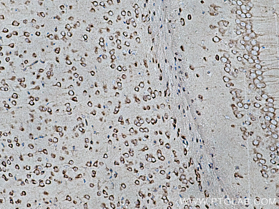 Immunohistochemistry (IHC) staining of mouse brain tissue using CARS Polyclonal antibody (15296-1-AP)