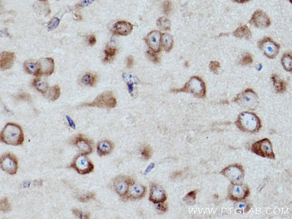 Immunohistochemistry (IHC) staining of mouse brain tissue using CARS Polyclonal antibody (15296-1-AP)