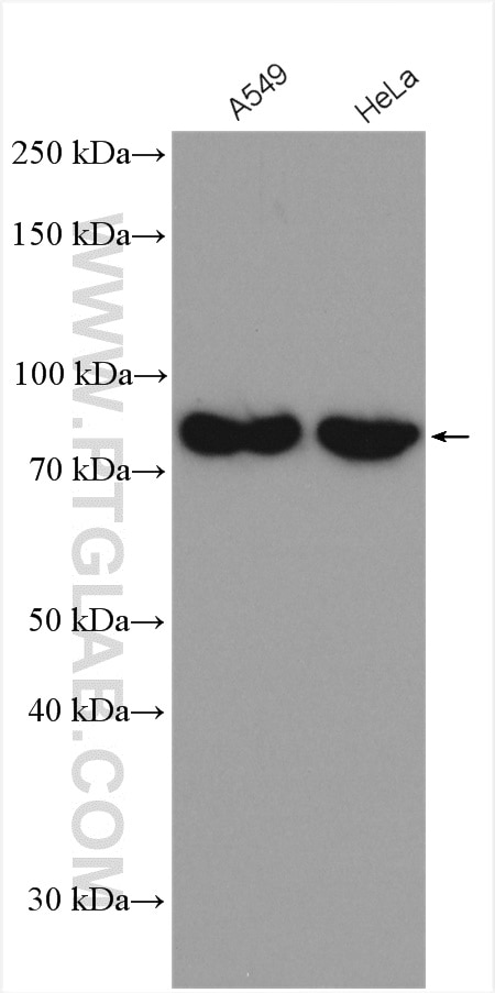 Western Blot (WB) analysis of various lysates using CARS Polyclonal antibody (15296-1-AP)