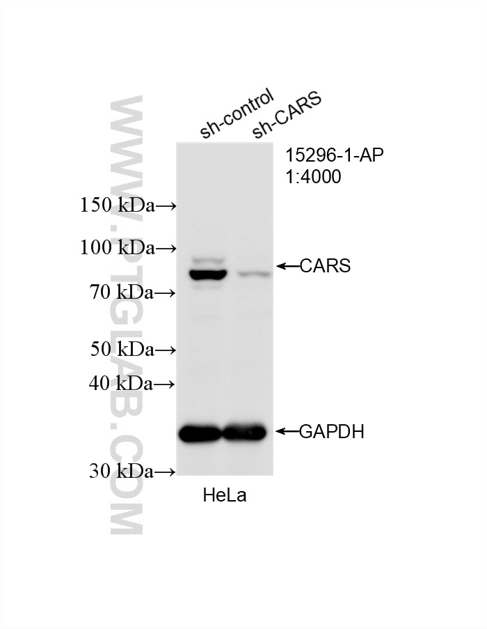 Western Blot (WB) analysis of HeLa cells using CARS Polyclonal antibody (15296-1-AP)