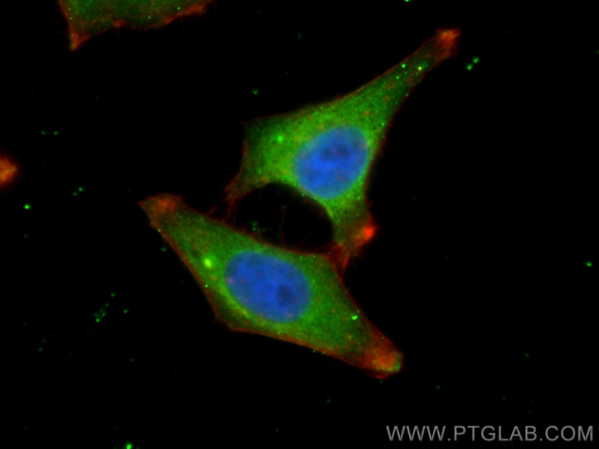 Immunofluorescence (IF) / fluorescent staining of HepG2 cells using CARS Monoclonal antibody (67933-1-Ig)