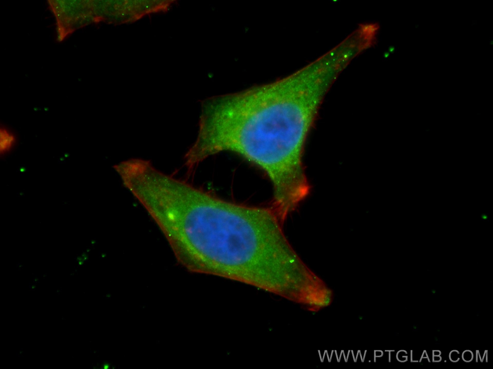 IF Staining of HepG2 using 67933-1-Ig