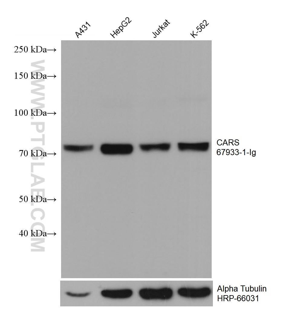 Western Blot (WB) analysis of various lysates using CARS Monoclonal antibody (67933-1-Ig)