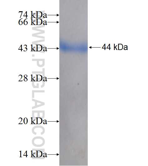 CARS fusion protein Ag7651 SDS-PAGE