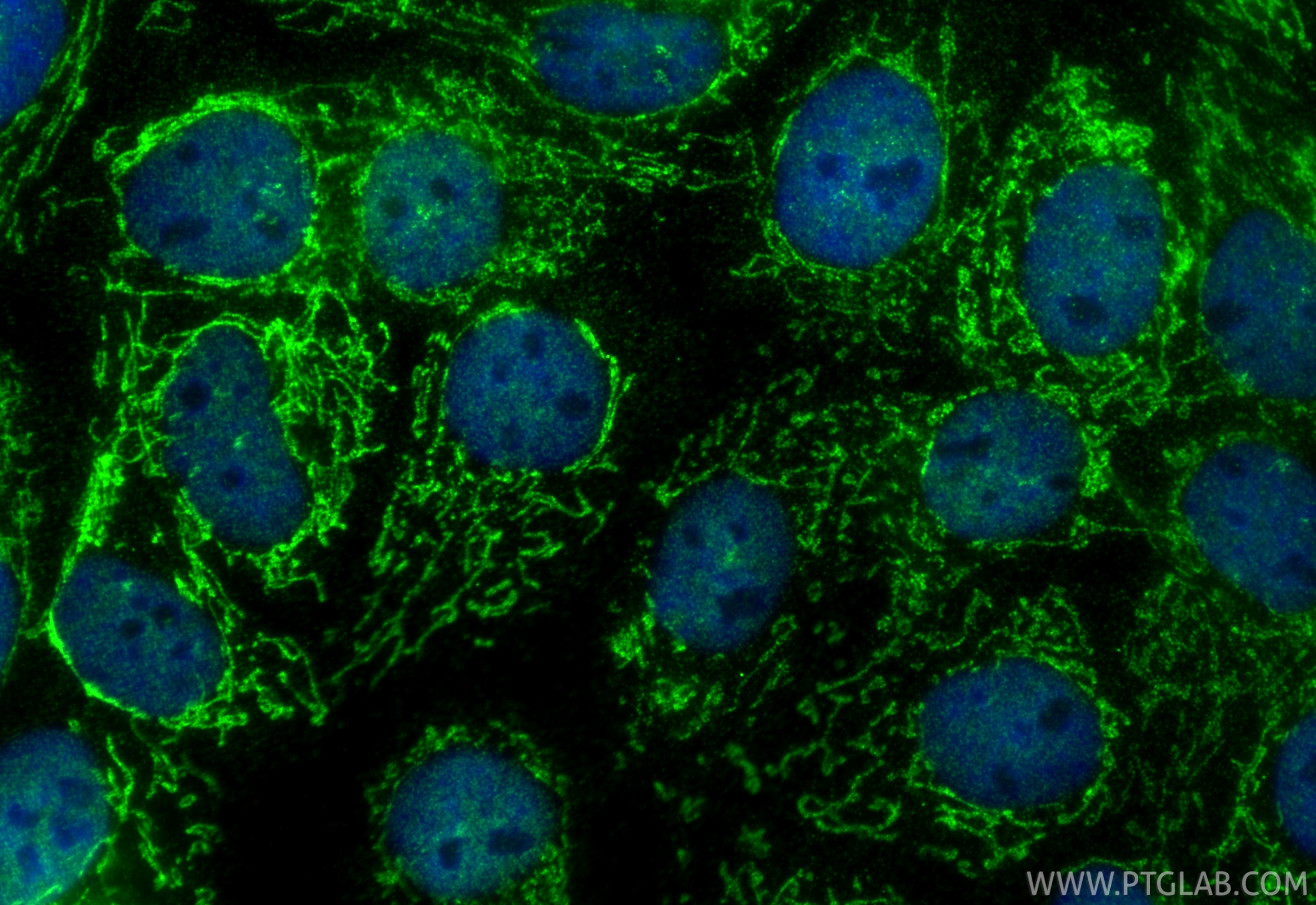 Immunofluorescence (IF) / fluorescent staining of A431 cells using CARS2 Polyclonal antibody (33597-1-AP)