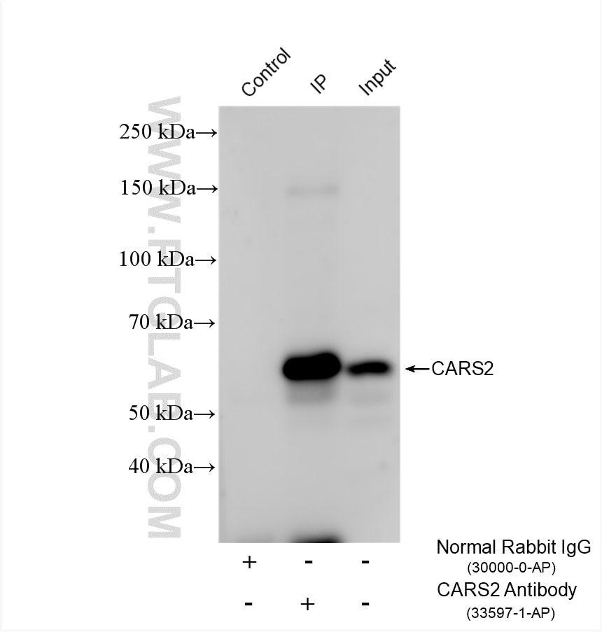 Immunoprecipitation (IP) experiment of SK-BR-3 cells using CARS2 Polyclonal antibody (33597-1-AP)