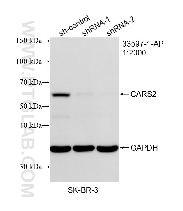 Western Blot (WB) analysis of SK-BR-3 cells using CARS2 Polyclonal antibody (33597-1-AP)