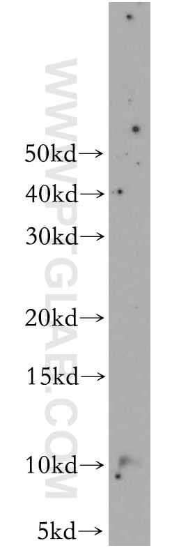 Western Blot (WB) analysis of human adrenal gland tissue using CARTPT Polyclonal antibody (13212-1-AP)