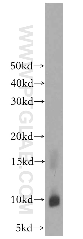 Western Blot (WB) analysis of SH-SY5Y cells using CARTPT Polyclonal antibody (13212-1-AP)