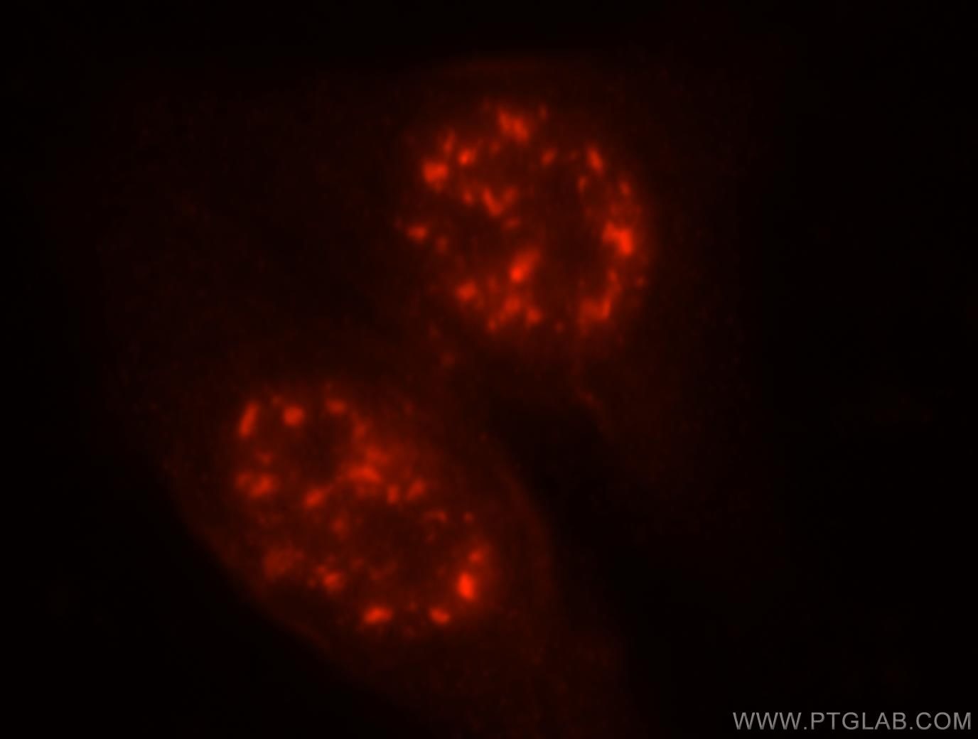 Immunofluorescence (IF) / fluorescent staining of HepG2 cells using MLN51/CASC3 Polyclonal antibody (18047-1-AP)