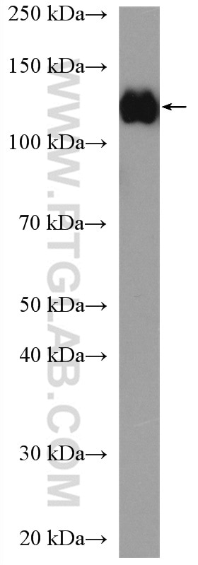 Western Blot (WB) analysis of MCF-7 cells using MLN51/CASC3 Polyclonal antibody (18047-1-AP)