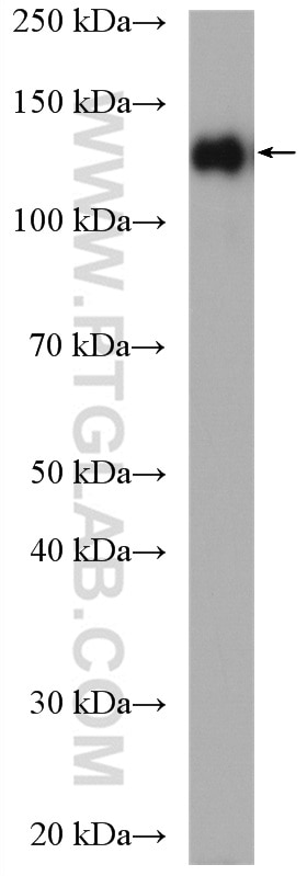 Western Blot (WB) analysis of SKOV-3 cells using MLN51/CASC3 Polyclonal antibody (18047-1-AP)