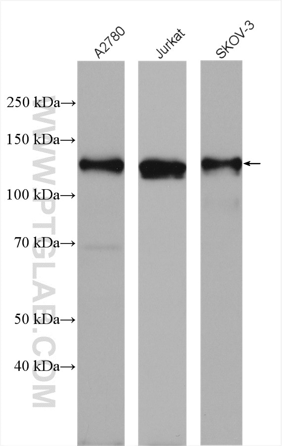 Western Blot (WB) analysis of various lysates using MLN51/CASC3 Polyclonal antibody (18047-1-AP)