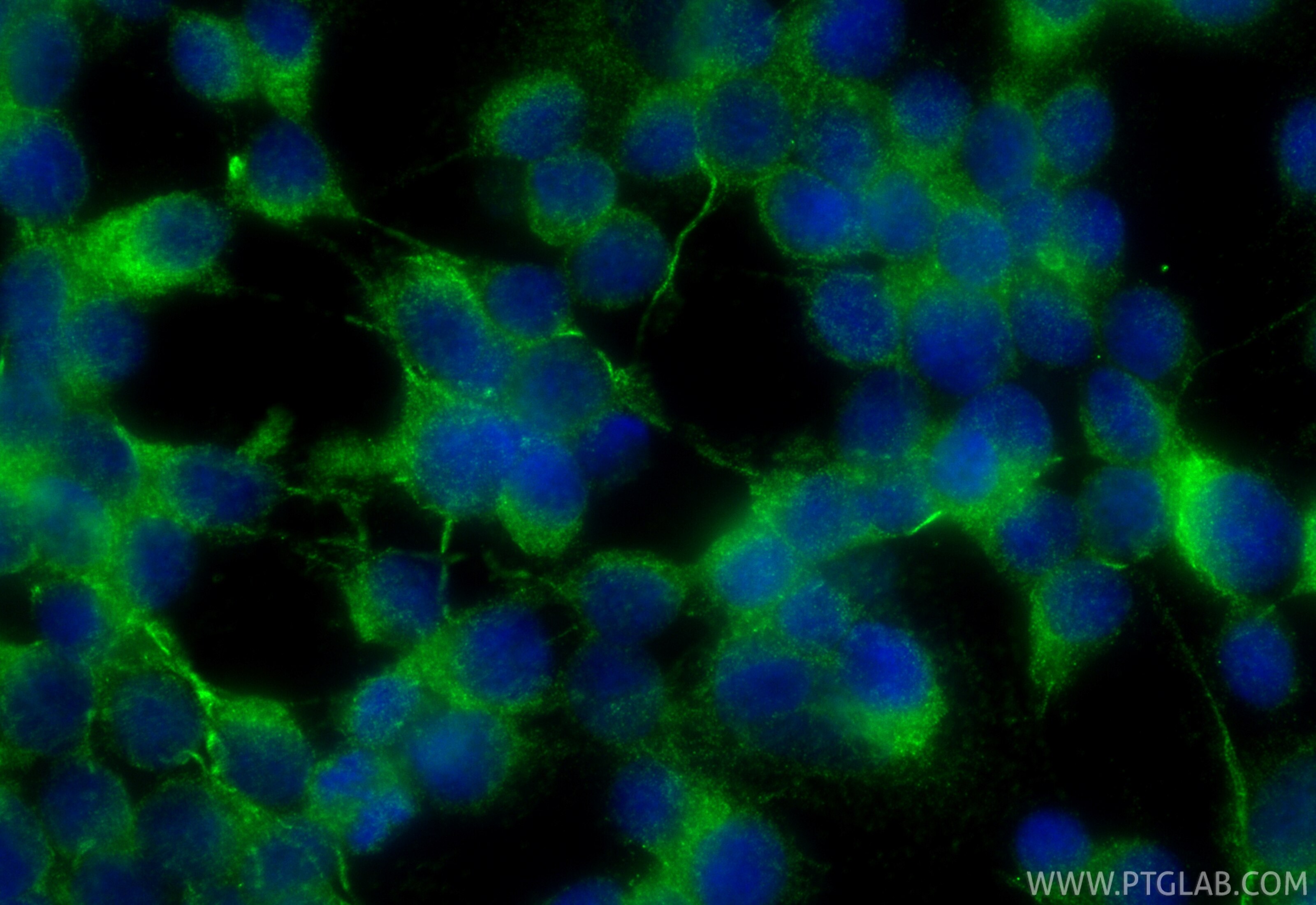 IF Staining of SH-SY5Y using 34104-1-AP Immunofluorescence (IF) / fluorescent staining of SH-SY5Y cells using CASD1 Polyclonal antibody (34104-1-AP)