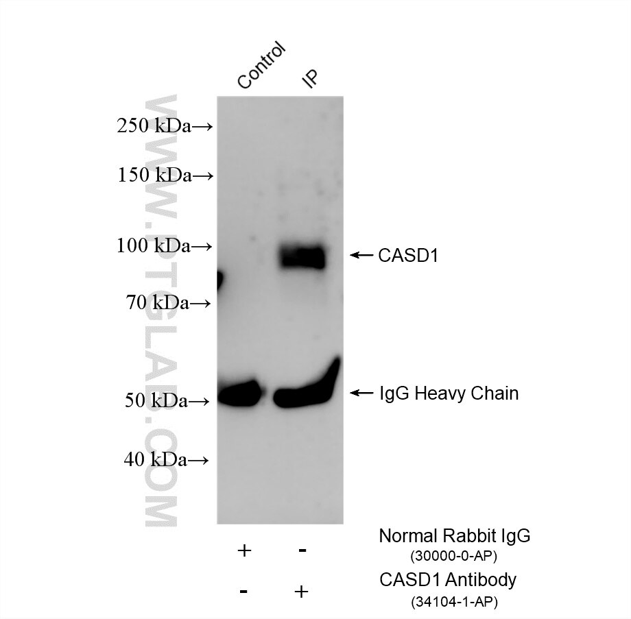Immunoprecipitation (IP) experiment of LNCaP cells using CASD1 Polyclonal antibody (34104-1-AP)