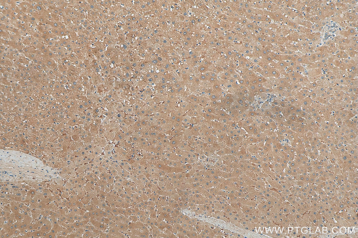 Immunohistochemistry (IHC) staining of human liver tissue using CASK Polyclonal antibody (55277-1-AP)