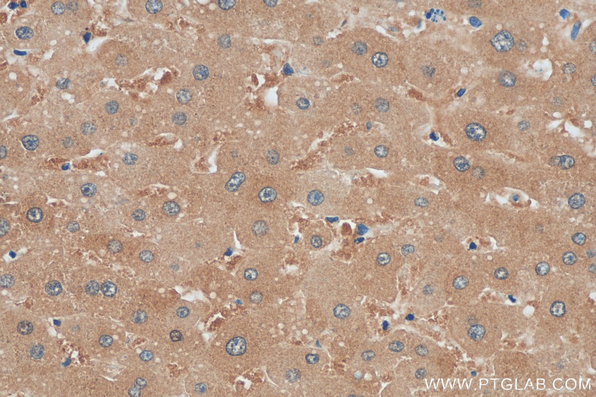Immunohistochemistry (IHC) staining of human liver tissue using CASK Polyclonal antibody (55277-1-AP)