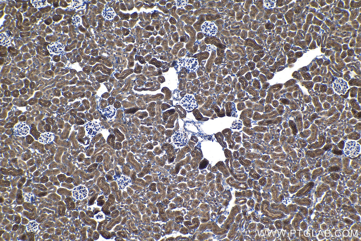 Immunohistochemistry (IHC) staining of mouse kidney tissue using CASK Polyclonal antibody (55277-1-AP)