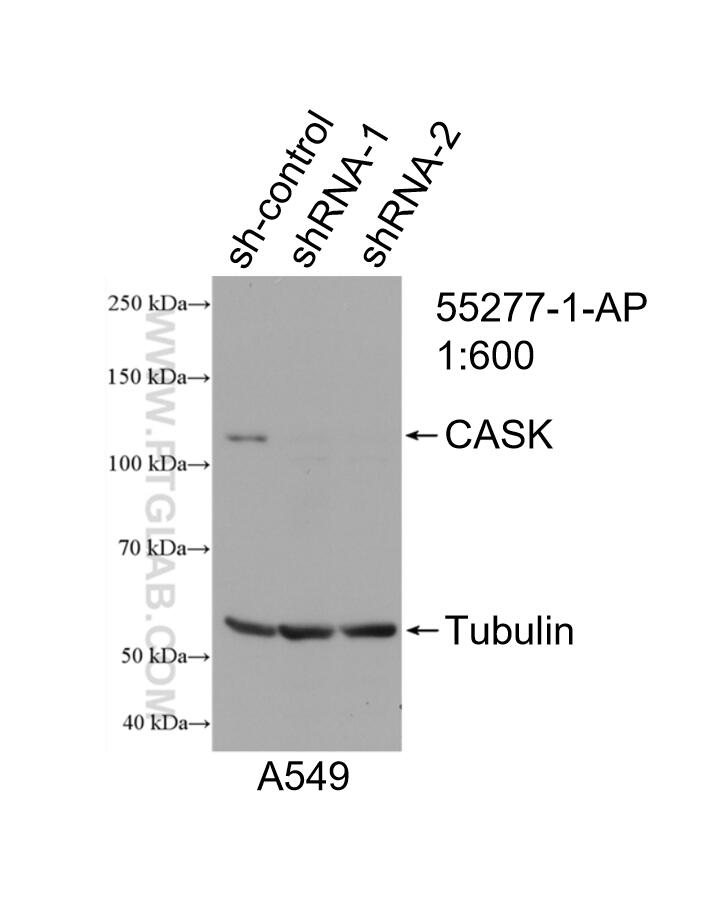 Western Blot (WB) analysis of A549 cells using CASK Polyclonal antibody (55277-1-AP)